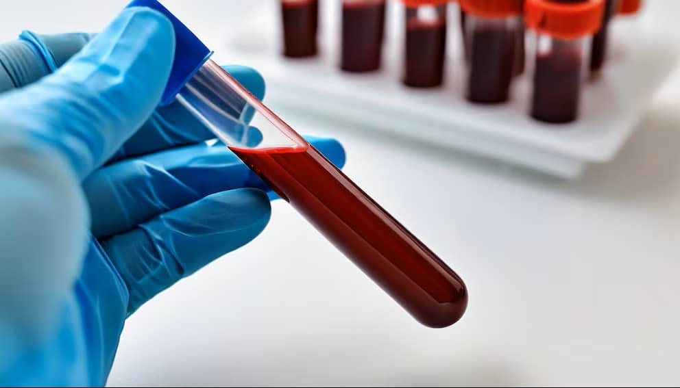 Byl objeven protein, který přispívá k rozvoji agresivnějšího karcinomu prsu, a probíhá výzkum zaměřený na nalezení způsobu, jak jej blokovat.