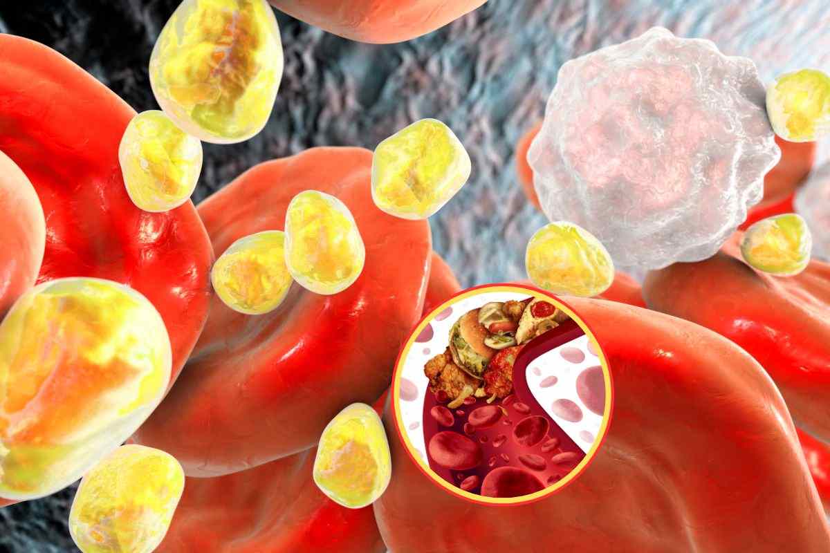 Vysoká hladina „dobrého“ cholesterolu představuje větší nebezpečí, než se dříve předpokládalo.